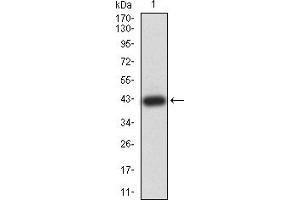 Western blot analysis using ROP1 mAb against Toxoplasma gondii rhoptry protein ROP1 (AA: 42-183) recombinant protein.