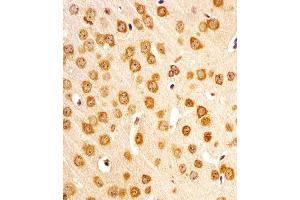 Immunohistochemistry (Paraffin-embedded Sections) (IHC (p)) image for anti-Nuclear Receptor Subfamily 4, Group A, Member 2 (NR4A2) (AA 164-197) antibody (ABIN6243917)