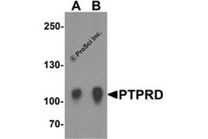 Western Blotting (WB) image for anti-Protein tyrosine Phosphatase, Receptor Type, D (PTPRD) (N-Term) antibody (ABIN1031529) (PTPRD Antikörper  (N-Term))