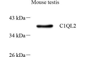 Western blot analysis of C1QL2 (ABIN7073561) at dilution of 1: 500 (C1QL2 Antikörper)