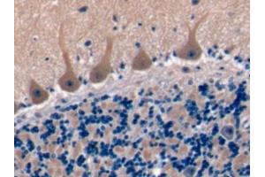Detection of TSPAN1 in Human Cerebellum Tissue using Polyclonal Antibody to Tetraspanin 1 (TSPAN1)