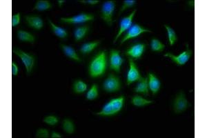 Immunofluorescence staining of A549 cells with ABIN7144534 at 1:166, counter-stained with DAPI. (ALOX15B Antikörper  (AA 1-676))
