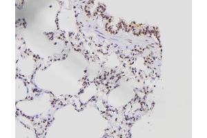 ABIN6276538 at 1/100 staining Rat lung tissue by IHC-P.