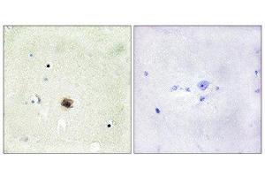 Immunohistochemistry (IHC) image for anti-Cysteine and Glycine-Rich Protein 1 (CSRP1) (Internal Region) antibody (ABIN1849240) (CSRP1 Antikörper  (Internal Region))