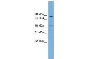 WB Suggested Anti-DNM1L  Antibody Titration: 0. (Dynamin 1-Like Antikörper  (N-Term))