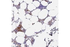 Immunohistochemical staining of human bone marrow with MEIG1 polyclonal antibody  shows strong cytoplasmic and nuclear positivity in subsets of hematopoietic cells at 1:200-1:500 dilution. (MEIG1 Antikörper)