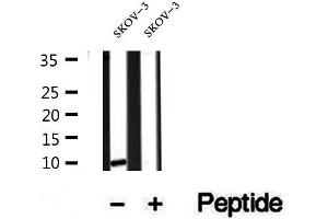 Western blot analysis of extracts of SKOV-3 cells, using SRP9 antibody. (SRP9 Antikörper  (Internal Region))