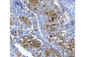 IHC analysis of FGFR2 using anti-FGFR2 antibody (ABIN7600690). (FGFR2 Antikörper  (AA 22-368))