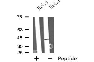 Western blot analysis of extracts from HeLa cells, using MTLR antibody. (Motilin Receptor Antikörper  (C-Term))