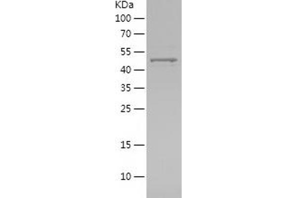 MMP13 Protein (AA 266-471) (His-IF2DI Tag)