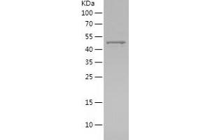 Western Blotting (WB) image for Matrix Metallopeptidase 13 (Collagenase 3) (MMP13) (AA 266-471) protein (His-IF2DI Tag) (ABIN7123853) (MMP13 Protein (AA 266-471) (His-IF2DI Tag))