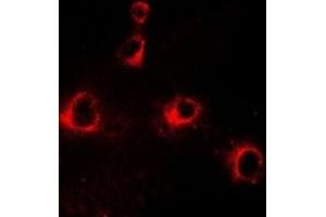 Immunofluorescent analysis of CD158b2 staining in HepG2 cells.