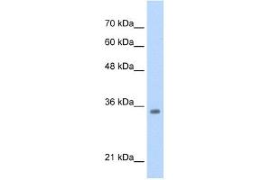 WB Suggested Anti-TCF4 Antibody  Titration: 0.