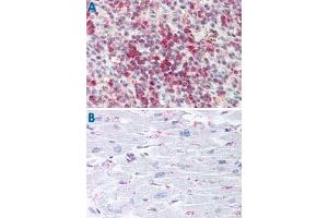 Immunohistochemistry (Formalin/PFA-fixed paraffin-embedded sections) of human spleen (A) and human heart tissue (B) with CYSLTR2 polyclonal antibody . (CasLTR2 Antikörper  (C-Term))