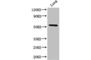 Western Blot Positive WB detected in: Mouse lung tissue All lanes: Q9NQ4 antibody at 3. (Solute Carrier Family 52 (Riboflavin Transporter), Member 3 (SLC52A3) (AA 159-220) Antikörper)