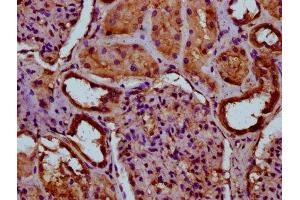 IHC image of ABIN7156513 diluted at 1:100 and staining in paraffin-embedded human kidney tissue performed on a Leica BondTM system. (ITIH3 Antikörper  (AA 512-651))