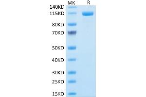 FAP Protein (AA 26-760) (Fc Tag)