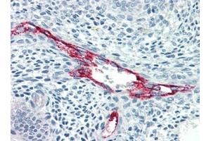 Immunohistochemistry (IHC) image for anti-Coagulation Factor VIII (F8) antibody (ABIN614478) (Factor VIII Antikörper)