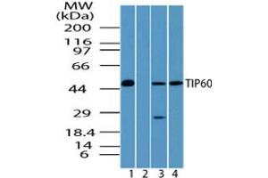 Image no. 2 for anti-K(lysine) Acetyltransferase 5 (KAT5) (AA 480-530) antibody (ABIN960242) (KAT5 Antikörper  (AA 480-530))