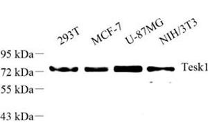 Western blot analysis of tesk1 (ABIN7075866) at dilution of 1: 500 (TESK1 Antikörper)