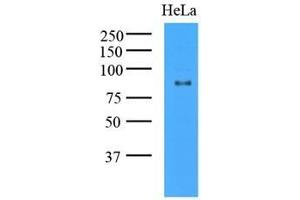 Cell lysates of HeLa (35 ug) were resolved by SDS-PAGE, transferred to nitrocellulose membrane and probed with anti-human GCN5L2 (1:1000). (KAT2A Antikörper  (AA 411-837))