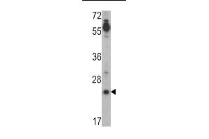 Western blot analysis of CRIPTO (TDGF1) Antibody (N-term) (ABIN388791 and ABIN2839123) in Jurkat cell line lysates (35 μg/lane). (TDGF1 Antikörper  (N-Term))