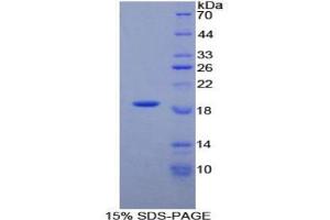 SDS-PAGE analysis of Human PLAA Protein. (PLAA Protein)
