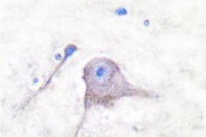 Image no. 2 for anti-Synaptosomal-Associated Protein, 25kDa (SNAP25) antibody (ABIN271818) (SNAP25 Antikörper)