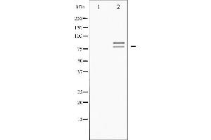 Western blot analysis of HSL phosphorylation expression in Adriamyci treated HeLa whole cell lysates,The lane on the left is treated with the antigen-specific peptide. (LIPE Antikörper  (pSer554, pSer855))