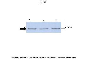 Lanes:   Lane 1: 30ug mouse renal epithelial lysate Lane 2: 30ug mouse renal epithelial lysate Lane 3: 30ug mouse renal epithelial lysate  Primary Antibody Dilution:   1:500  Secondary Antibody:   Anti-rabbit-HRP  Secondary Antibody Dilution:   1:2500  Gene Name:   CLIC1  Submitted by:   Dr. (CLIC1 Antikörper  (C-Term))