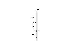 Anti-MC Antibody (Center) at 1:1000 dilution + K562 whole cell lysate Lysates/proteins at 20 μg per lane. (MCAM Antikörper  (AA 161-189))