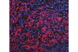 IF analysis of Cytokeratin 20/Krt20 using anti-Cytokeratin 20/Krt20 antibody (ABIN7601133). (KRT20 Antikörper  (AA 29-431))