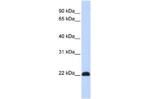 WB Suggested Anti-KLF16 Antibody Titration:  0. (KLF16 Antikörper  (N-Term))