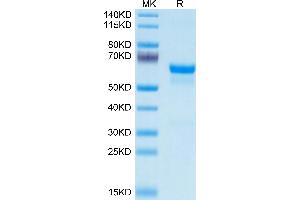 PRNP Protein (AA 23-230) (Fc Tag)