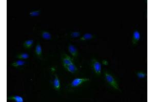 Immunofluorescent analysis of Hela cells using ABIN7159505 at dilution of 1:100 and Alexa Fluor 488-congugated AffiniPure Goat Anti-Rabbit IgG(H+L)