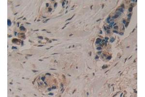 Used in DAB staining on fromalin fixed paraffin- embedded liver tissue (LIFR Antikörper  (AA 45-184))