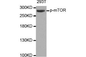 Western blot analysis of extracts of 293T cell line, using phospho-MTOR-S2448 antibody. (MTOR Antikörper  (pSer2448))