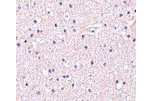 Immunohistochemistry of NCSTN in human brain tissue with NCSTN polyclonal antibody  at 5 ug/mL . (Nicastrin Antikörper  (C-Term))