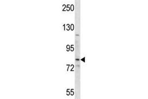 SMO antibody western blot analysis in HepG2 lysate. (SMO Antikörper  (AA 539-567))