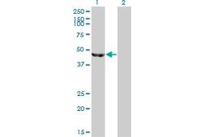 Western Blot analysis of ENO3 expression in transfected 293T cell line by ENO3 monoclonal antibody (M01), clone 5D1. (ENO3 Antikörper  (AA 228-277))