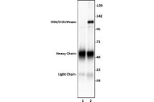 OGA/O-GlcNAcase antibody (pAb) tested by Immunoprecipitation.