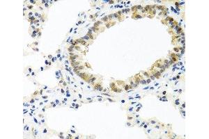 Immunohistochemistry of paraffin-embedded Rat lung using BMP5 Polyclonal Antibody at dilution of 1:100 (40x lens). (BMP5 Antikörper)