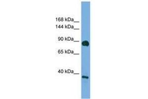 Image no. 1 for anti-Discs, Large Homolog 4 (Drosophila) (DLG4) (AA 683-732) antibody (ABIN6749749) (DLG4 Antikörper  (AA 683-732))