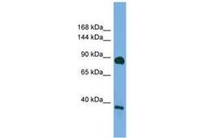 Image no. 1 for anti-Discs, Large Homolog 4 (Drosophila) (DLG4) (AA 683-732) antibody (ABIN6749749)