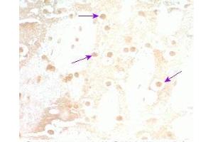 Rat brain tissue was stained by Rabbit Anti-Neuromedin S Prepro (70-103) (Mouse) Serum (NMS Antikörper  (Preproprotein))