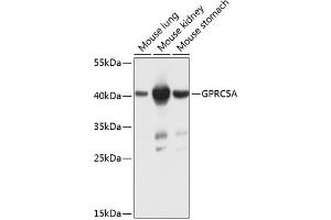 Western blot analysis of extracts of various cell lines, using GPRC5A antibody (ABIN6131897, ABIN6141357, ABIN6141358 and ABIN6224198) at 1:1000 dilution. (GPRC5A Antikörper  (AA 258-357))