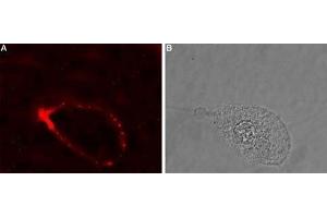 Expression of GlyRα4 in human retinal epithelium (ARPE-19) - Cell surface detection of GlyRα4 in intact living human ARPE-19 cells. (GLRA4 Antikörper  (Extracellular, N-Term))