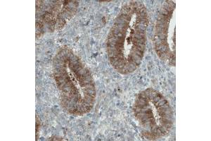 Immunohistochemical staining (Formalin-fixed paraffin-embedded sections) of human uterus with DIAPH2 monoclonal antibody, clone CL1111  shows strong cytoplasmic immunoreactivity in glandular cells. (DIAPH2 Antikörper)