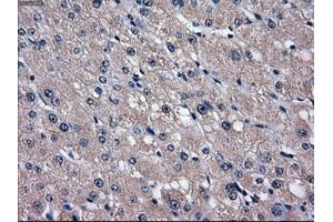 Immunohistochemical staining of paraffin-embedded liver tissue using anti-SLC2A5mouse monoclonal antibody. (SLC2A5 Antikörper)
