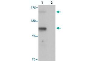 Western blot analysis of RUSC2 in SK-N-SH cell lysate with RUSC2 polyclonal antibody  at 1 ug/mL in (lane 1) the absence and (lane 2) the presence of blocking peptide.